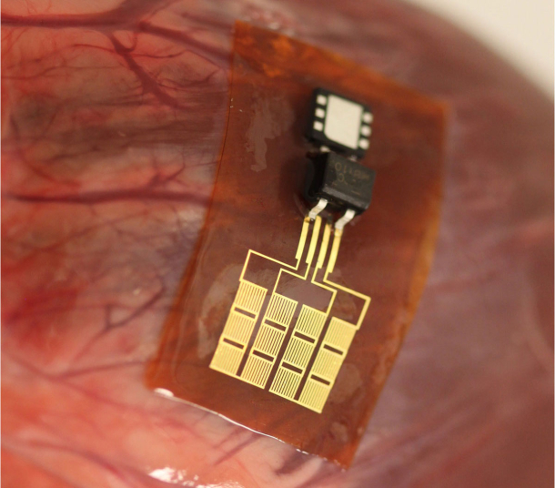 Piezoelectric nanoribbons power pacemakers