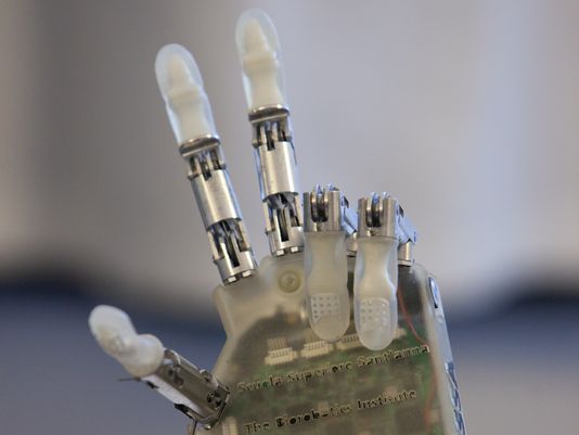 Trial:  Improved sense of touch and control in prosthetic hand