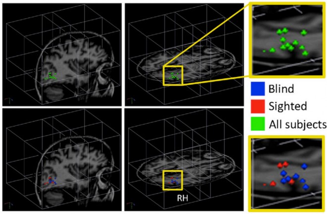 Visual cortex activated by audio stimuli