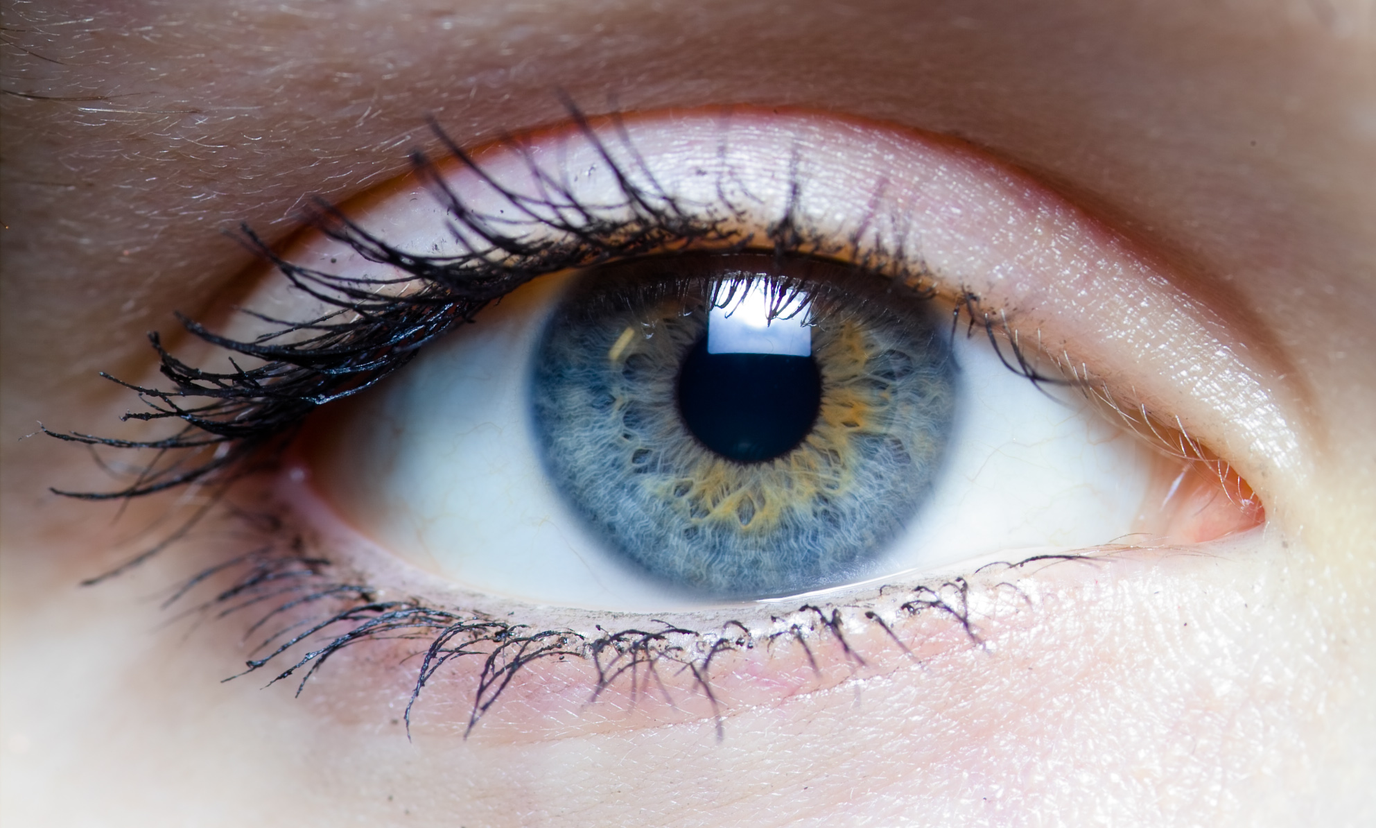 Eye sensor tracks intraocular pressure changes