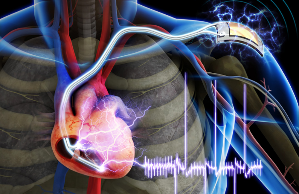 Self powered piezoelectric pacemaker