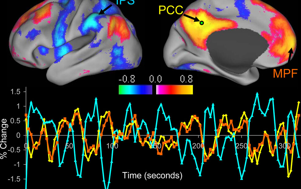 Brain Network Map May Improve Non-invasive Stimulation – ApplySci