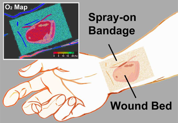 “Smart bandage” changes color as wounds heal