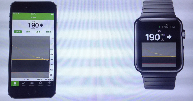 Apple watch will track glucose