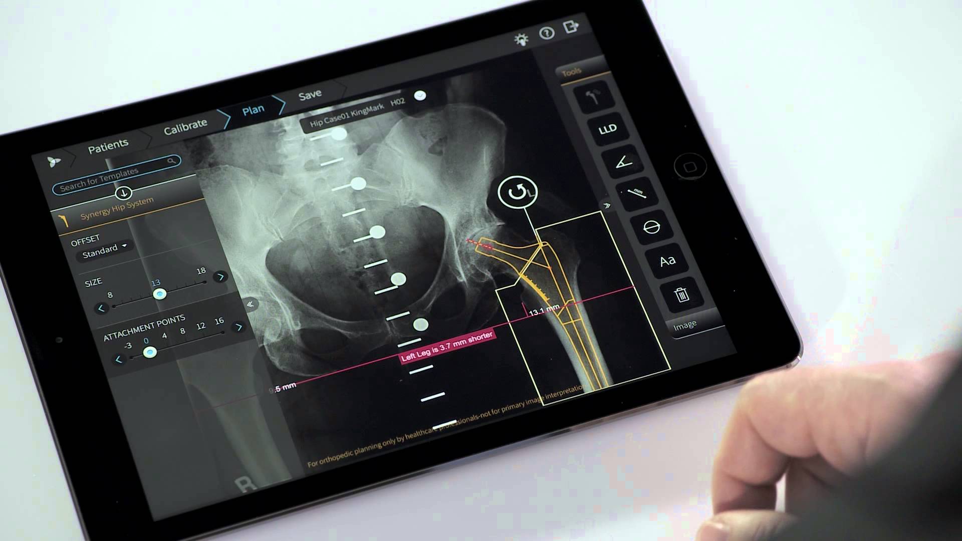 App helps orthopedic surgeons plan procedures