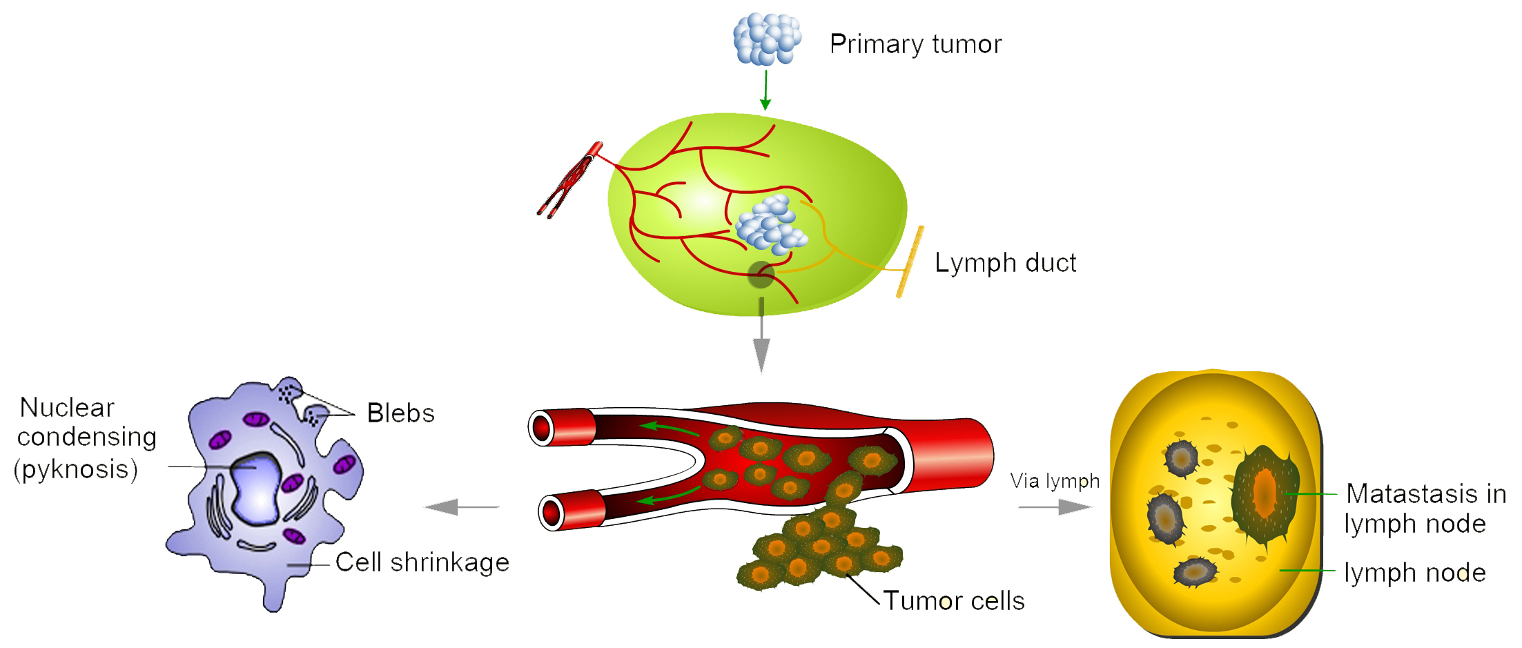 Nanosensor cancer detection