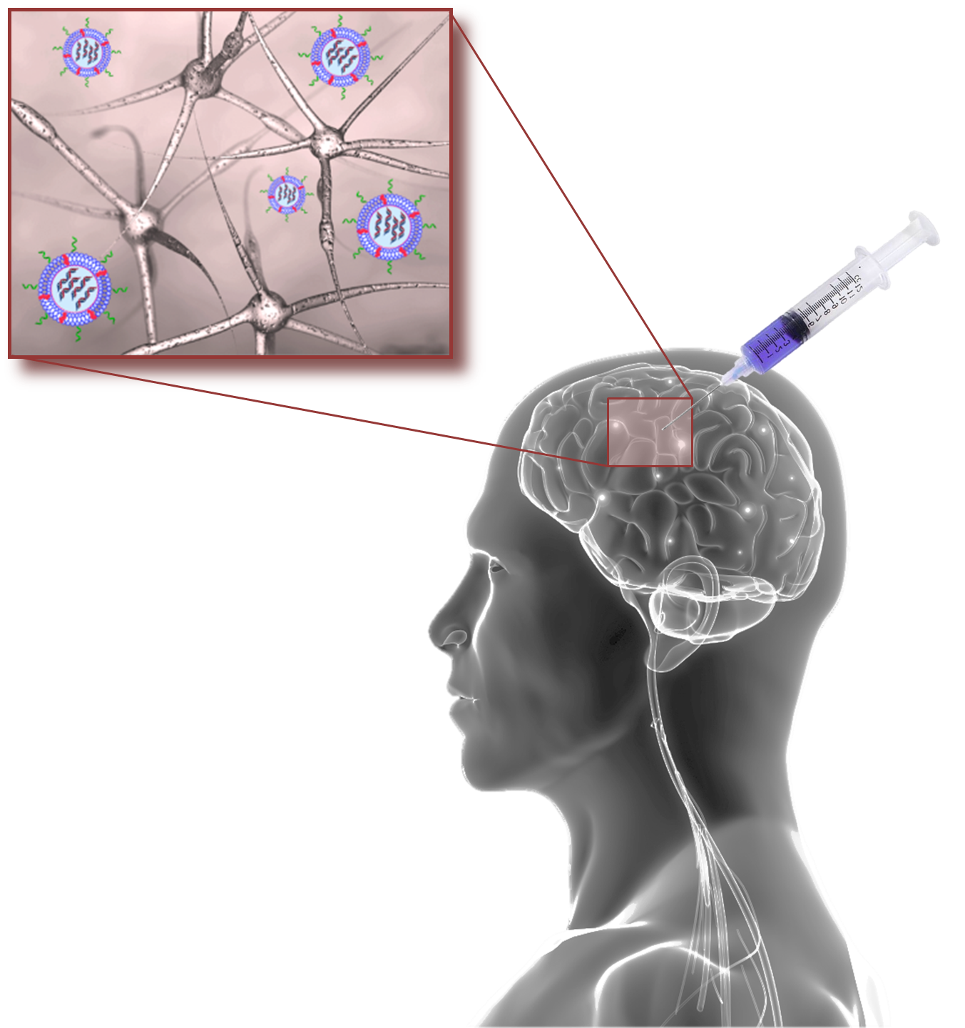Nanoparticle treatment targets brain tumors