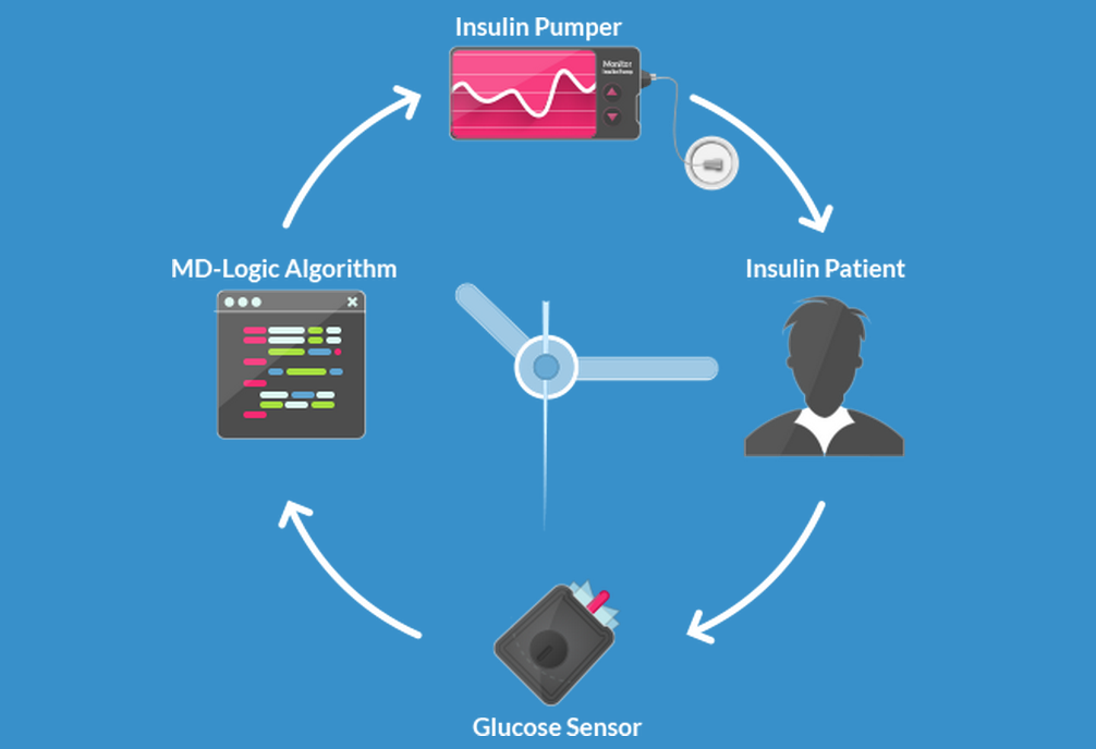 Closed-loop glucose monitoring system