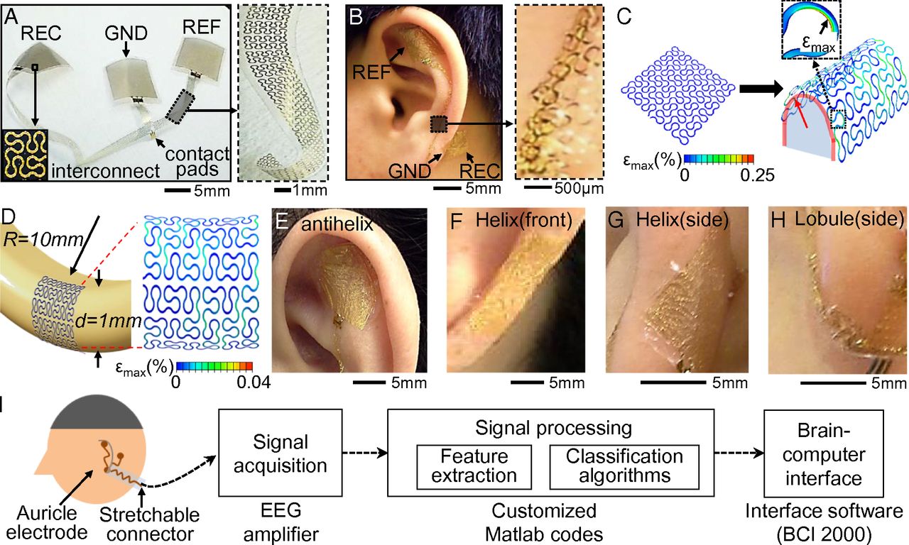 Discreet EEG sticker monitors brain activity