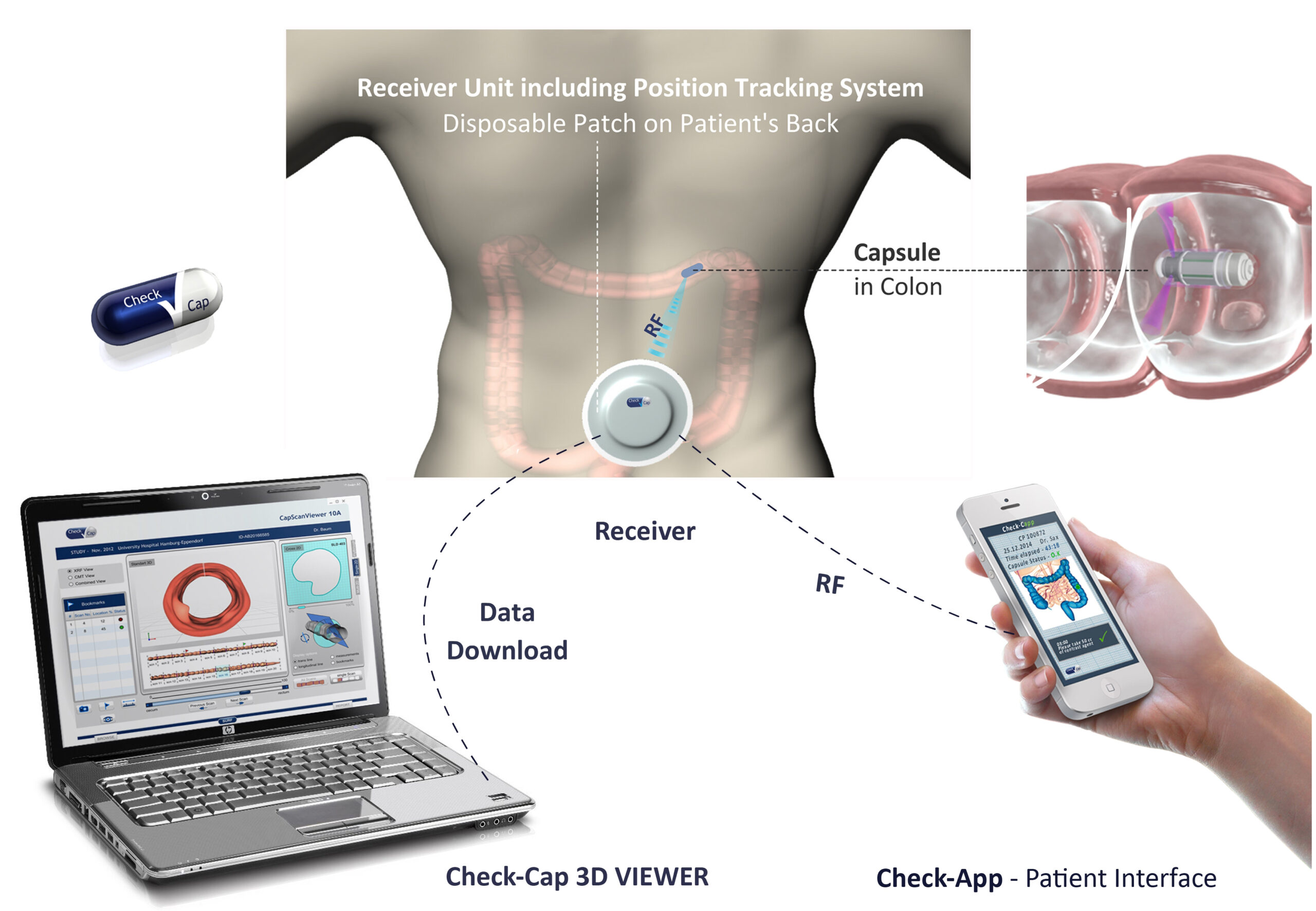 Sensor pill for 3D colon imaging
