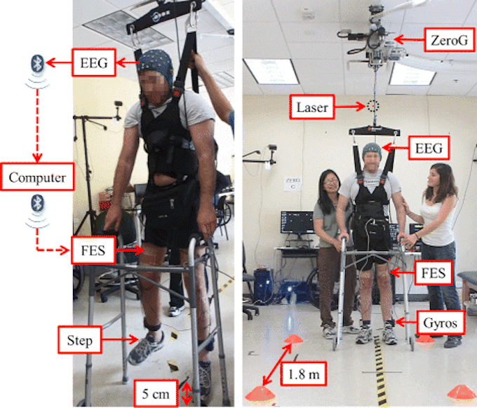 Paraplegic walks, lightly supported, for 12 feet, with BCI triggered muscle stimulation