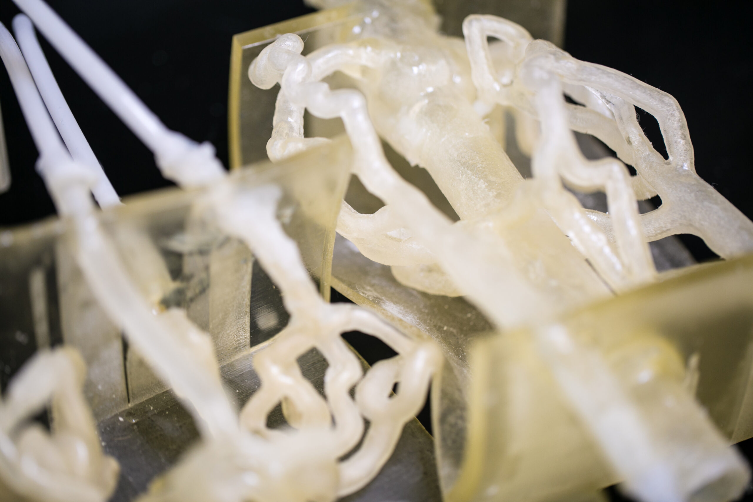 3D printed model for brain aneurysm surgery planning