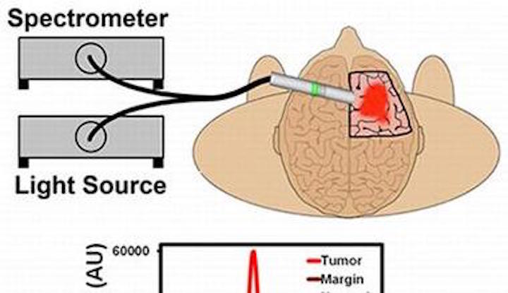 Handheld spectrometer identifies low-grade brain tumors