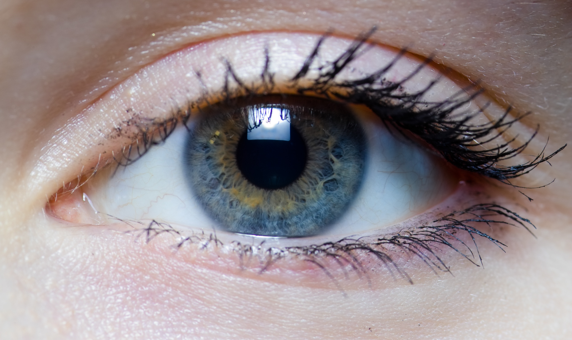 Smart contact lens could detect Glaucoma progression