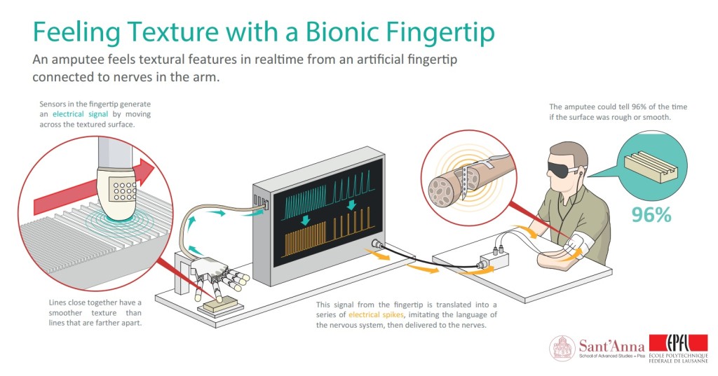 Bionic finger, implanted electrodes, enable amputee to “feel” texture