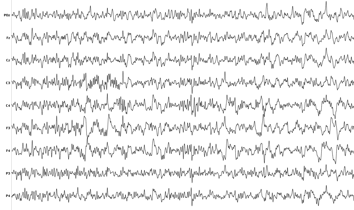 EEG “password” uses stimulus response to confirm identity