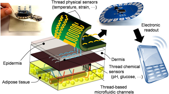 Implanted thread provides real-time diagnostic data