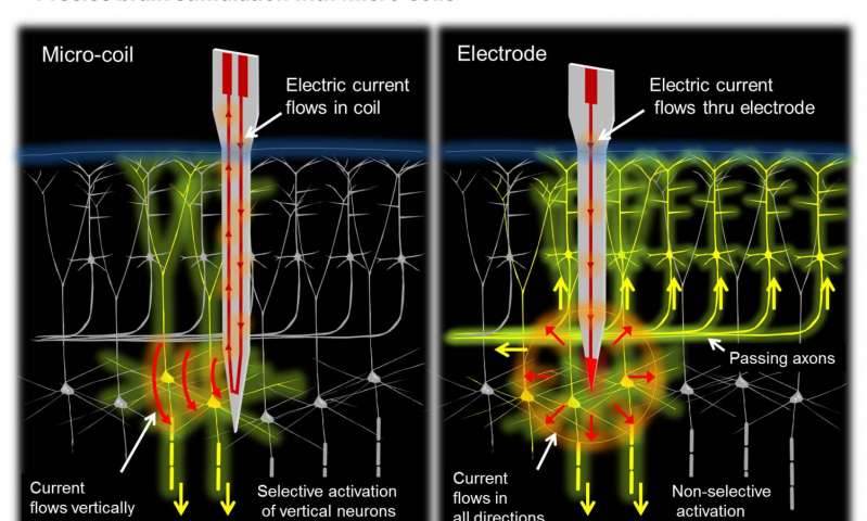 Magnetic coils might improve neural prostheses