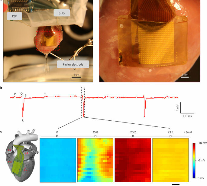 Thin, flexible, insulated sensor could monitor the heart for 70 years ApplySci