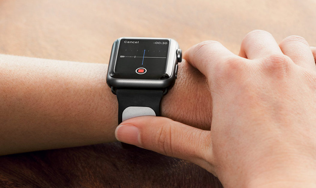 FDA approved EKG band monitors heart activity via Apple Watch