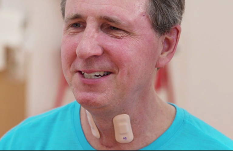 Throat-worn sensor-sticker transforms stroke rehab – ApplySci