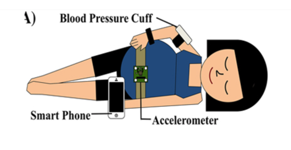 BP cuff + accelerometer detect early preeclampsia