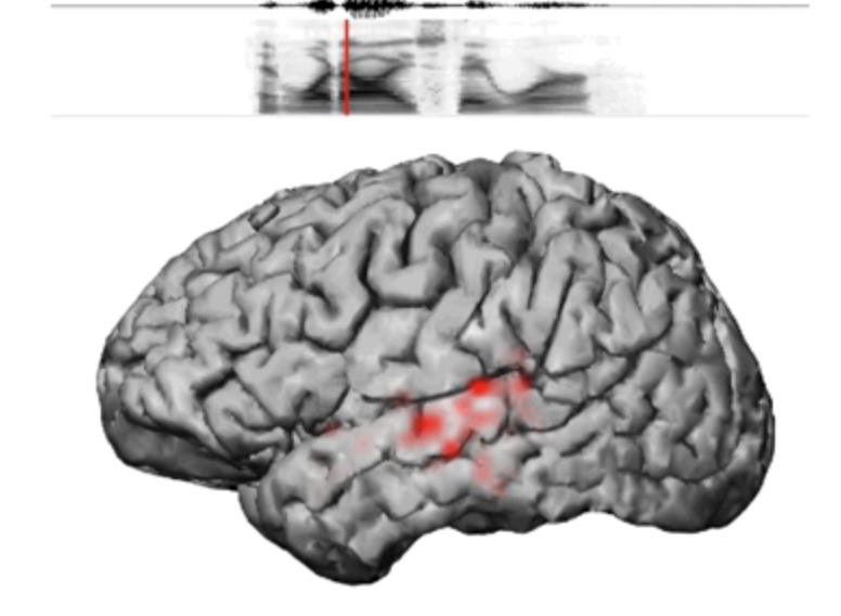 Neural signals translated into speech