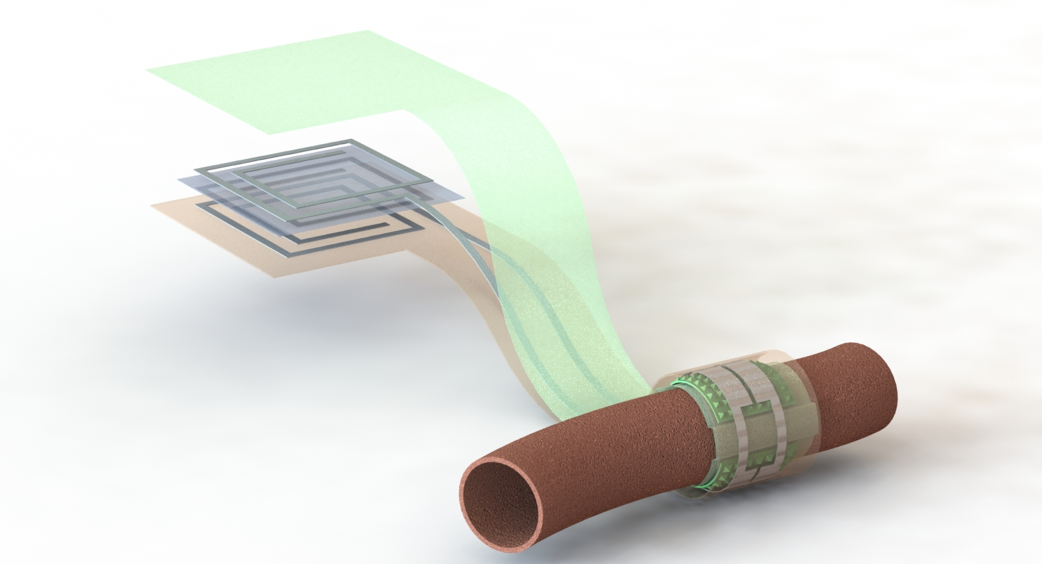 Wireless,biodegradable, flexible arterial-pulse sensor monitors blood flow
