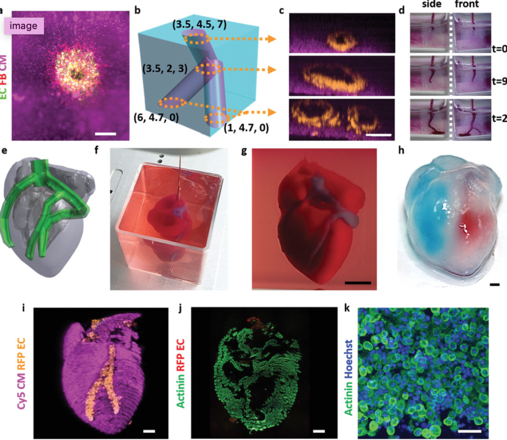 3D Printed, Vascularized Heart, Using Patient’s Cell, Biological ...