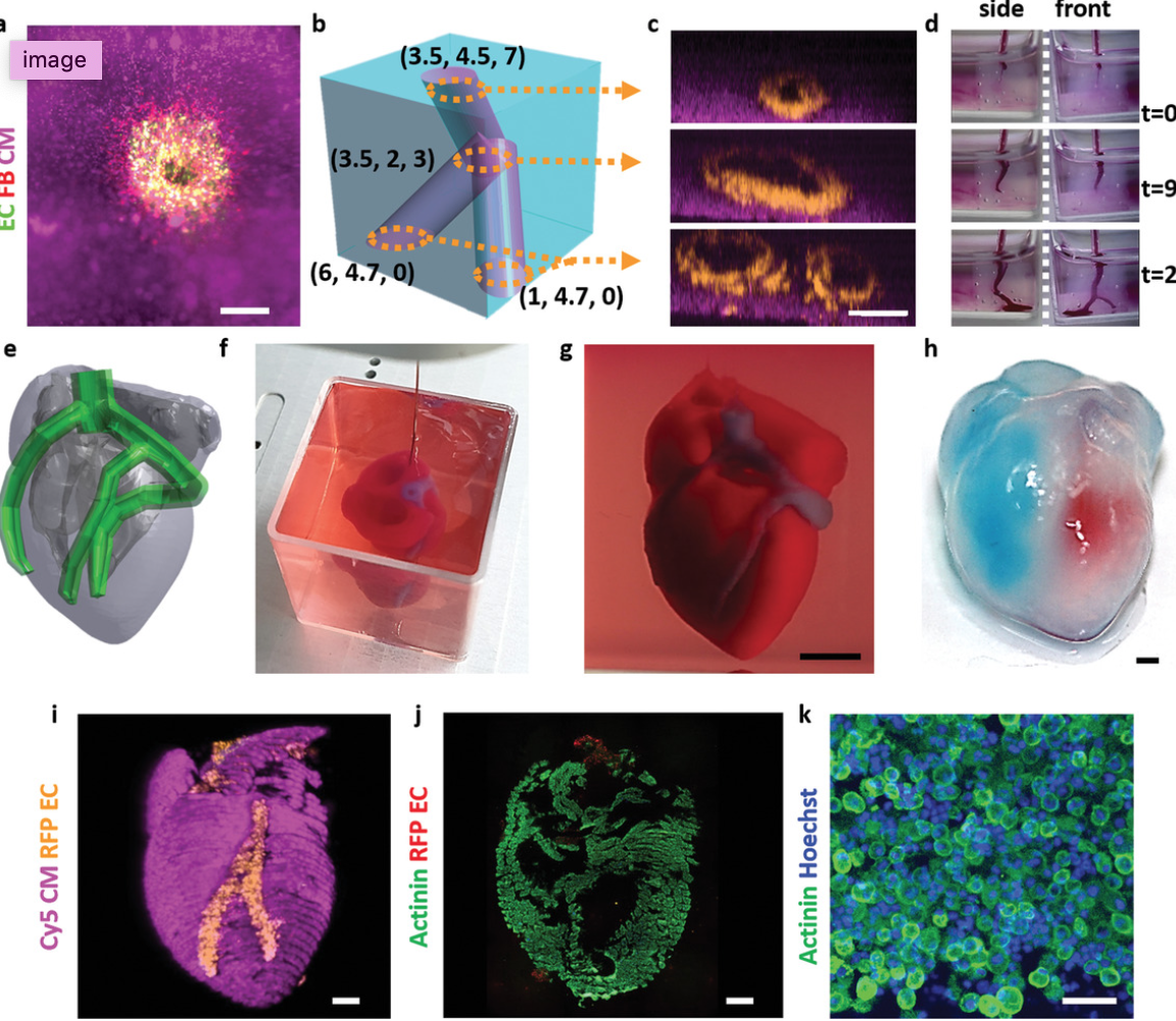 3D printed, vascularized heart, using patient’s cell, biological materials