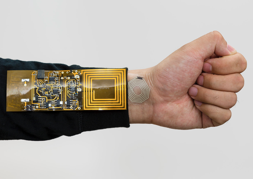 Printed stickers, stretchable antennas, fluctuation-resistant RFID for continuous whole-body monitoring