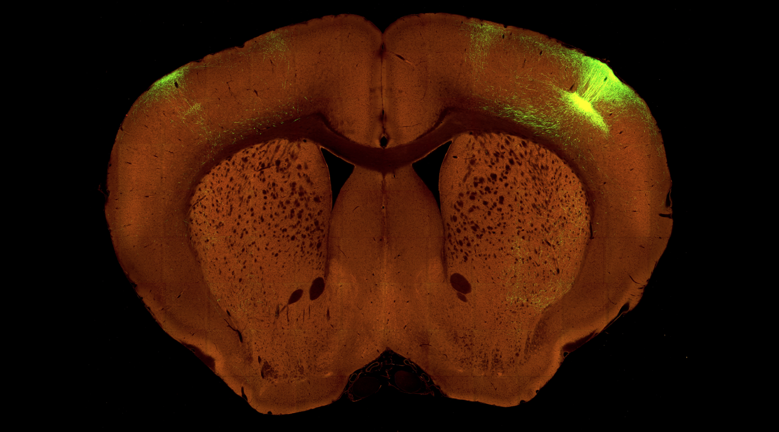 High resolution brain map traces wiring within, between, thalamus and cortex
