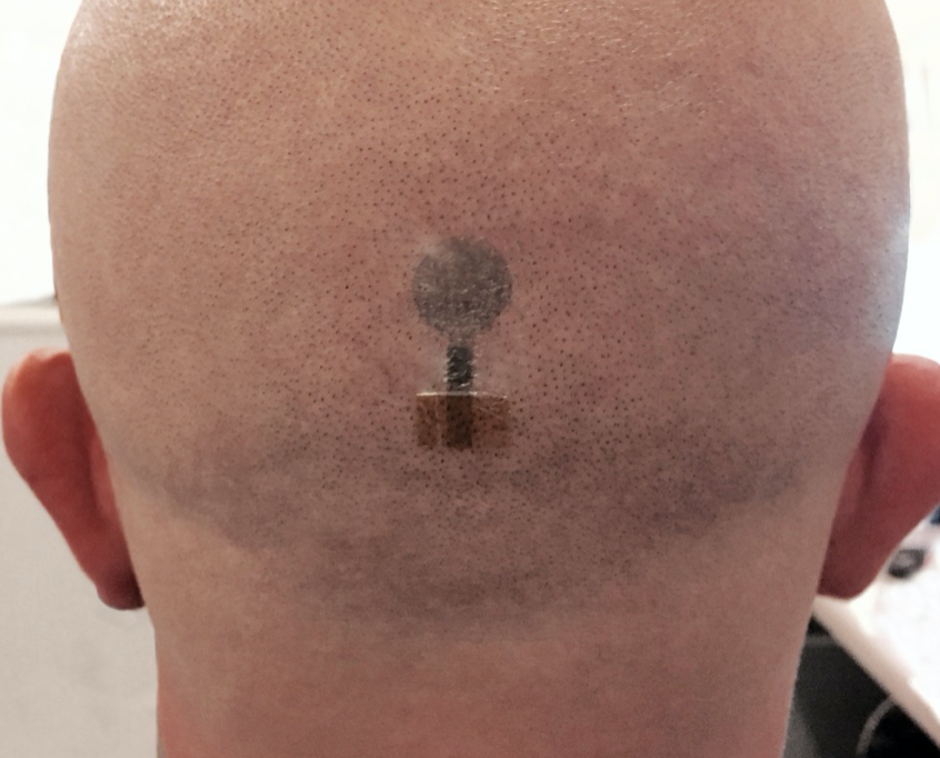 Tattoo electrodes for long-term EEG, MEG measurements