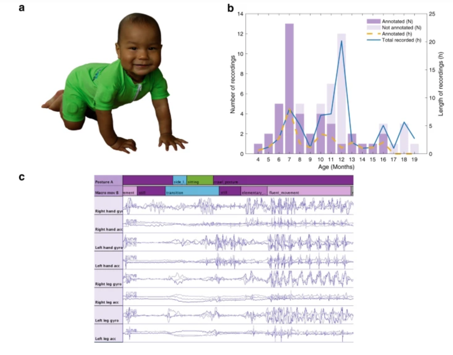 Sensor jumpsuit monitors infant motor abilities