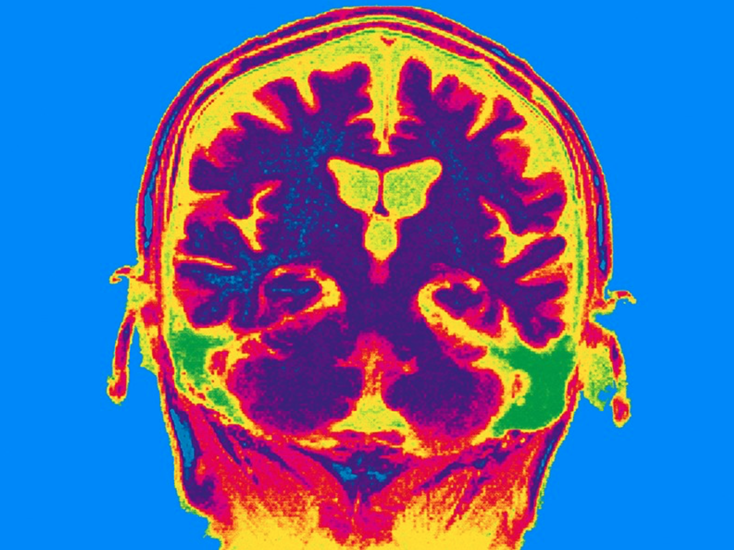Non-invasive stimulation improves memory in study